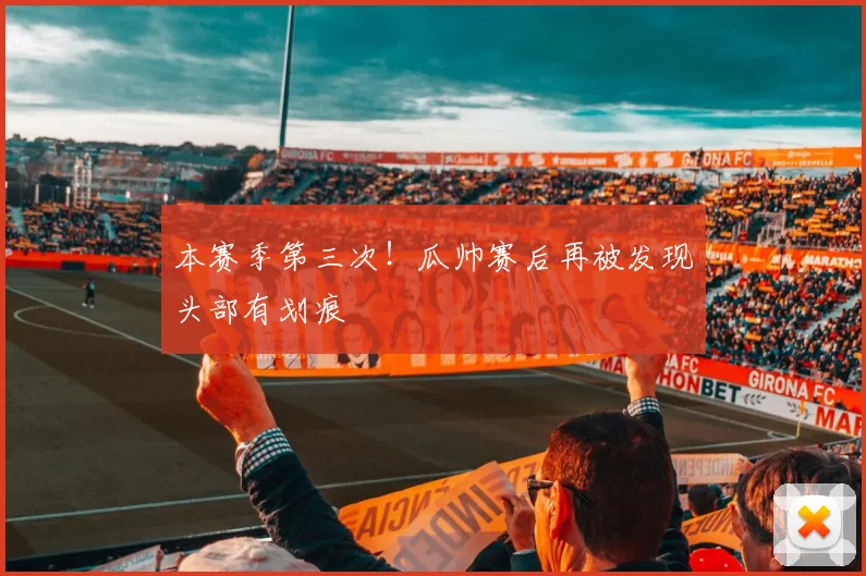 本赛季第三次！瓜帅赛后再被发现头部有划痕